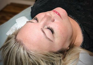 Eyelash Extensions - Before And After Photos of Balance Med Spa & Salon in Beverly Hills, FL Eyelash Extensions - Before And After Photos of Balance Med Spa & Salon in Beverly Hills, FL