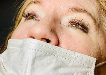 Eyelash Extensions - Before And After Photos of Balance Med Spa & Salon in Lecanto, FL Eyelash Extensions - Before And After Photos of Balance Med Spa & Salon in Lecanto, FL