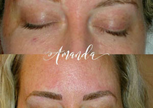 Microblading & Eyebrows - Before And After Photos of Balance Med Spa & Salon in Lecanto, FL Microblading & Eyebrows - Before And After Photos of Balance Med Spa & Salon in Lecanto, FL