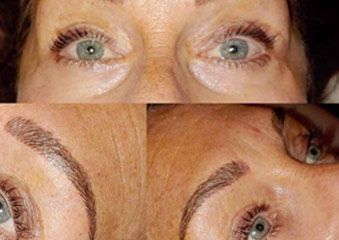 Microblading & Eyebrows - Before And After Photos of Balance Med Spa & Salon in Lecanto, FL Microblading & Eyebrows - Before And After Photos of Balance Med Spa & Salon in Lecanto, FL