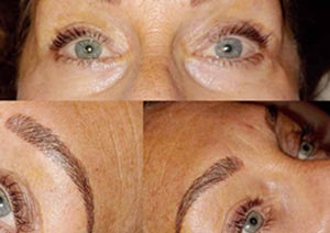 Microblading & Eyebrows - Before And After Photos of Balance Med Spa & Salon in Lecanto, FL Microblading & Eyebrows - Before And After Photos of Balance Med Spa & Salon in Lecanto, FL