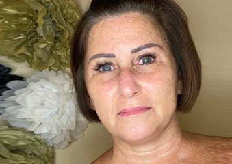 Microblading & Eyebrows - Before And After Photos of Balance Med Spa & Salon in Lecanto, FL Microblading & Eyebrows - Before And After Photos of Balance Med Spa & Salon in Lecanto, FL
