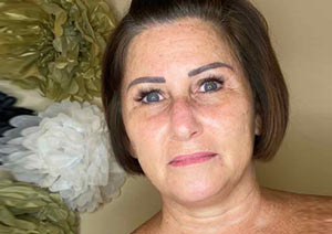 Microblading & Eyebrows - Before And After Photos of Balance Med Spa & Salon in Lecanto, FL Microblading & Eyebrows - Before And After Photos of Balance Med Spa & Salon in Lecanto, FL