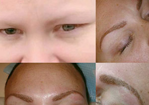 Microblading & Eyebrows - Before And After Photos of Balance Med Spa & Salon in Lecanto, FL Microblading & Eyebrows - Before And After Photos of Balance Med Spa & Salon in Lecanto, FL