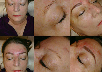 Microblading & Eyebrows - Before And After Photos of Balance Med Spa & Salon in Lecanto, FL Microblading & Eyebrows - Before And After Photos of Balance Med Spa & Salon in Lecanto, FL