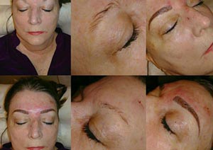 Microblading & Eyebrows - Before And After Photos of Balance Med Spa & Salon in Lecanto, FL Microblading & Eyebrows - Before And After Photos of Balance Med Spa & Salon in Lecanto, FL