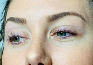 Microblading & Eyebrows - Before And After Photos of Balance Med Spa & Salon in Beverly Hills, FL Microblading & Eyebrows - Before And After Photos of Balance Med Spa & Salon in Beverly Hills, FL
