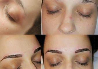 Microblading & Eyebrows - Before And After Photos of Balance Med Spa & Salon in Lecanto, FL Microblading & Eyebrows - Before And After Photos of Balance Med Spa & Salon in Lecanto, FL