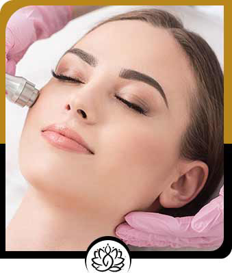 Microdermabrasion in Beverly Hills, FL