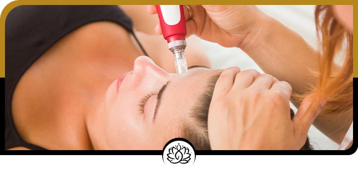 SkinPen Treatment Specialist Near Me in Brandon, FL