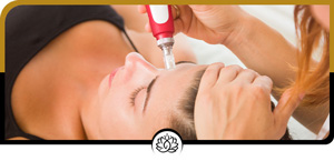 SkinPen Treatment Specialist Near Me in Brandon, FL